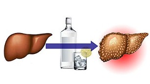 los efectos del alcohol en el hígado
