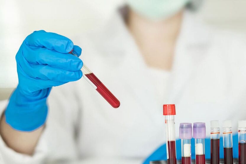 ¿Es posible beber alcohol antes de donar sangre